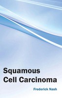 Frederick Nash | Squamous Cell Carcinoma | Buch | Englisch (2015) | Gebunden