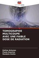 Kaline Antunes (U. A.) | Tomographie Multicoupe Avec Une Faible Dose De...