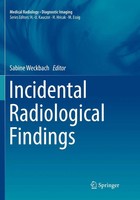 Incidental Radiological Findings | Sabine Weckbach | Englisch | Taschenbuch | Ix