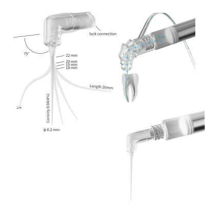 Dental Endodontic Endo Irrigation Needle Tip Disposable Root Canal Syringe Tips