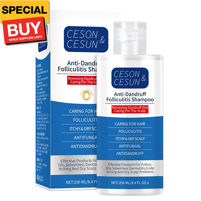 Anti-Fungal Shampoo for Folliculitis, Effective Seborrheic Dermatitis Scalp Psor