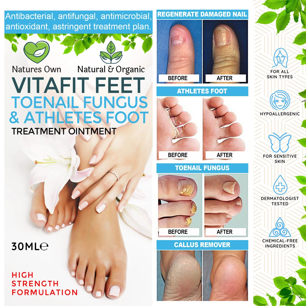 Nail Treatment Feet Care Essence Nail Foot Whitening Toe Nail Fungus Removal  Gel | eBay