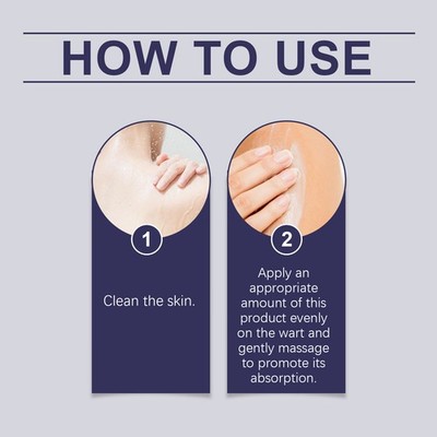 Wart Remover Ointment Gentle Nourishing Body Lotion for Smooth Skin