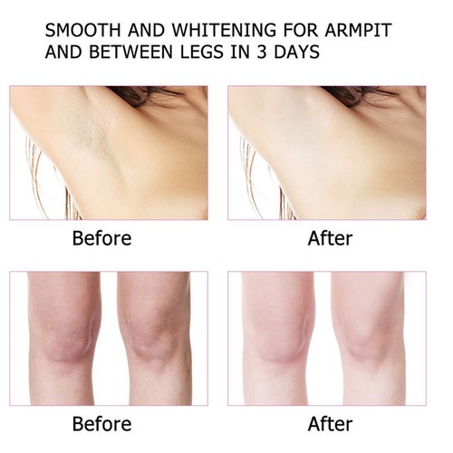 Whitening Cream For Underarms Remove Melanin, Prevent Odor, Stop Sweating - Picture 12 of 12