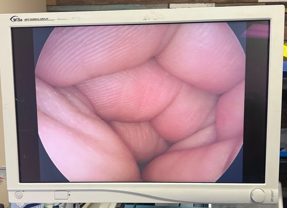 Stryker 502-206-045 IDEAL EYES HD 红外高温减肥瞄准镜 5 毫米 x 45o 45 厘米 — 第 3/4 张图片