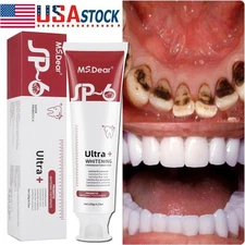 SP6 Probiotic Toothpaste for Oral Gum Health, Reduces Plaque Fresh Breath