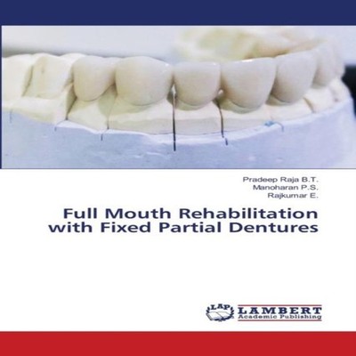 Full Mouth Rehabilitation with Fixed Partial Dentures Pradeep Raj