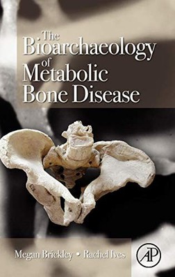 THE BIOARCHAEOLOGY OF METABOLIC BONE DISEASE By Megan B. Brickley & Rachel Ives