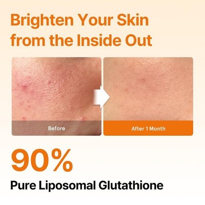 ESTHER FORMULA Liposomal Glutathione Strips (30 ct) - Glutathione Direct,  Ant... | eBay