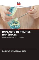 Swathi Vardhan Kasi | Implants Dentaires ImmÉDiats | Taschenbuch | FranzöSisch