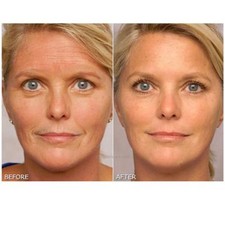 ANTI WRINKLE CREAM, INSTANT FACE CREAM FINE LINE CREAM. WORKS INSTANTLY!????????