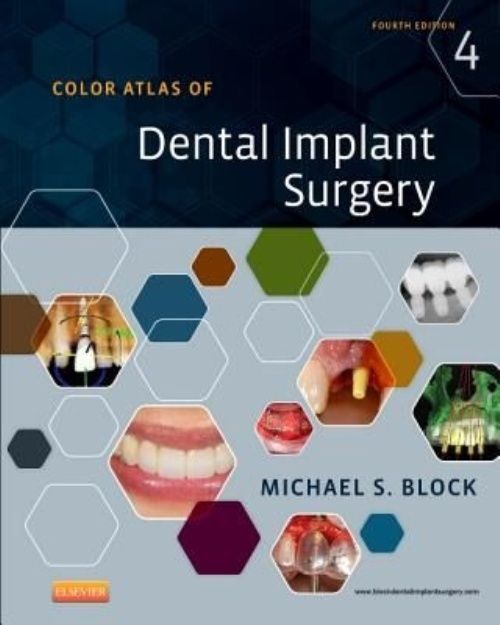 Color Atlas of Dental Implant Surgery Block Hardback Saunders 9781455759682 4e