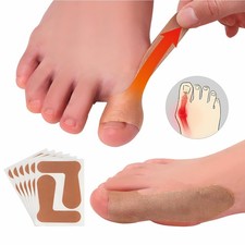 Big toe valgus orthotics  Best bunion corrector, 20 PCS Self Adhesive Big Toe