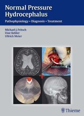 Normal Pressure Hydrocephalus Pathophysiology - Diagnosis - Treatment Buch 2014
