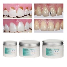 Temporary Tooth Filling Repair Kit Solid Glue for Teeth Veneer Uneven Teeth