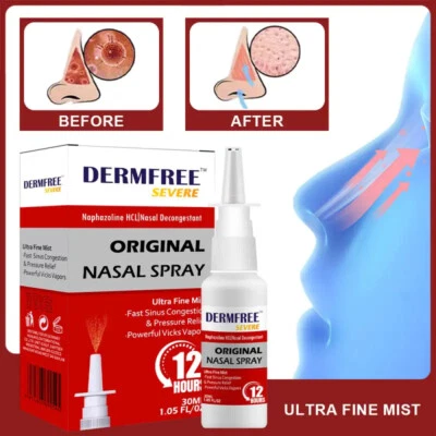 DERMFREE Rhinitis Nasal Spray 12 Hours Fast Relief Nasal Congestion Snoring Sneezing Nose