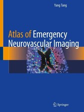 Atlas of Emergency Neurovascular Imaging | Ya...