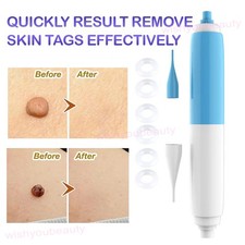 2in1 Natural Painless Skin Tag Remover Pen Skin Tag Mole Wart Dark Spot Removal