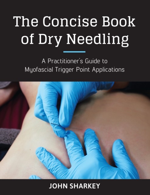 The Concise Book of Dry Needling: A Practitioner's by John Sharkey PAPERBACK