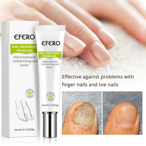 Toe Be Health Instant Beauty Gel New - Picture 4 of 12