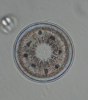 Baker Antique Microscope Slide. Actinocyclus Diatom “Very Rare”