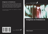 ImáGenes En Endodoncia Vikas Swami