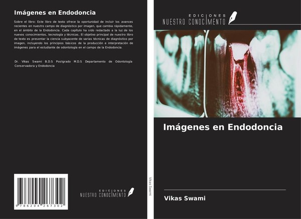 ImáGenes En Endodoncia Vikas Swami-image