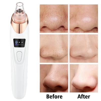 Electric Blackhead Remover Pore Vacuum Suction Diamond Dermabrasion Face Cleaner