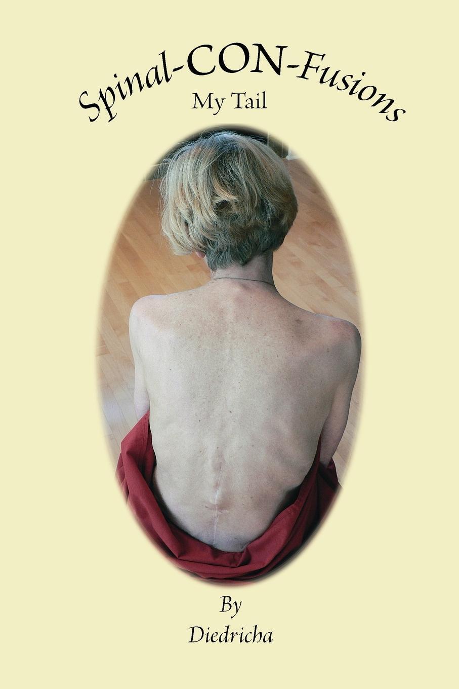 Thumbnail - Diedricha | Spinal Con-fusions, My Tail | Taschenbuch | Englisch