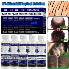 2~10 Bottles Hair Regrowth Treatment Hair Loss &Growth Scalp 50ML Liquid for Men