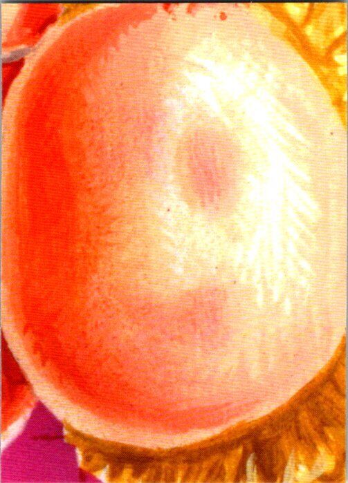Picture 177 of 201