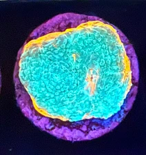 Live Coral Sps Chalice