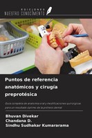 Puntos De Referencia AnatóMicos Y CirugíA PreprotéSica Bhuvan Divekar