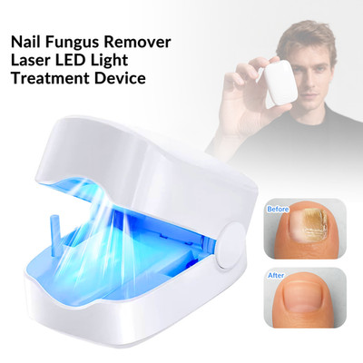 Nail Fungus Laser Therapy Device 940nm Infrared 500nm Blue Light Onychomycosis
