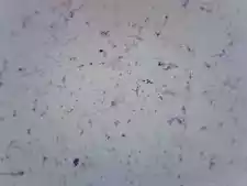 Vibrio Cholerae Smear - Prepared Slide - 75x25mm - Eisco Labs