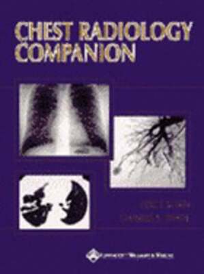 Chest Radiology Companion: Methods, Guidelines, and Imaging Fundamentals: Used