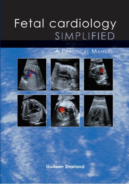 Fetal Cardiology Simplified: A Practical Manual by Gurleen Sharland... - Image 4