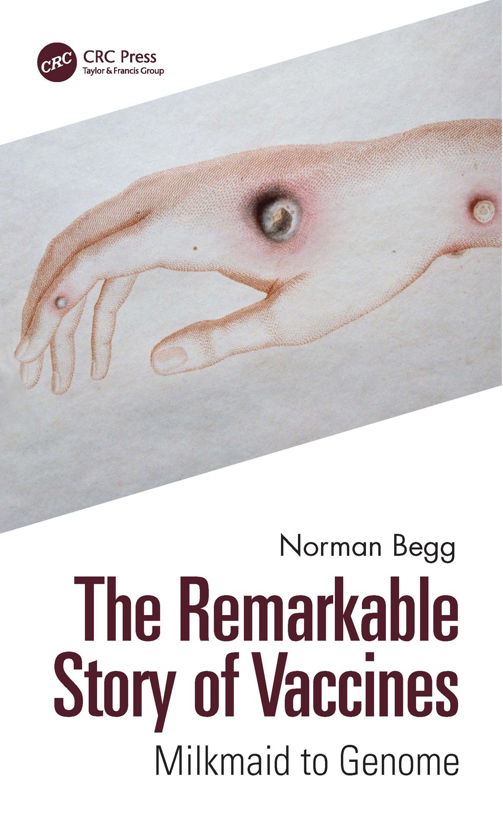 Remarkable Story of Vaccines