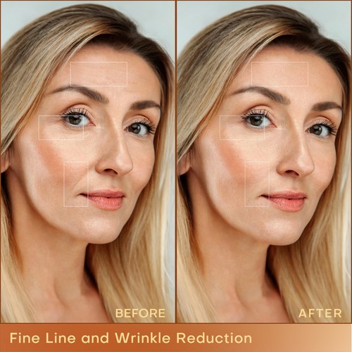 Professionelle RF Beauty Maschine, Radiofrequenz Gesichtsmaschine mit 2 Sonden, a... - Bild 5 von 7