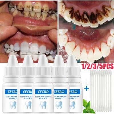 Teeth Whitening Essence Extra Strong White Hygiene Tooth Whitener Stain Removal