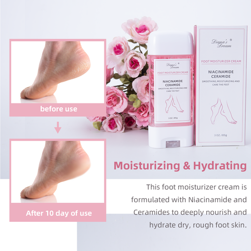 Moisturizer Foot Cream for Dry Cracked Heels Feet Hydrate Rough Skin - Picture 9 of 40