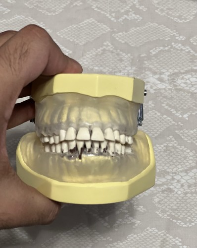 KM-C-210 Articulated Periodontal Soft Clear Gingival Typodont Model