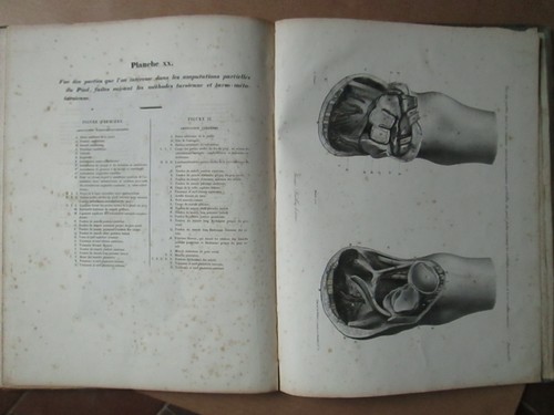 BLANDIN : ATLAS D'ANATOMIE CORPS HUMAIN, 1834. 20 planches lithographiées - Picture 11 of 12