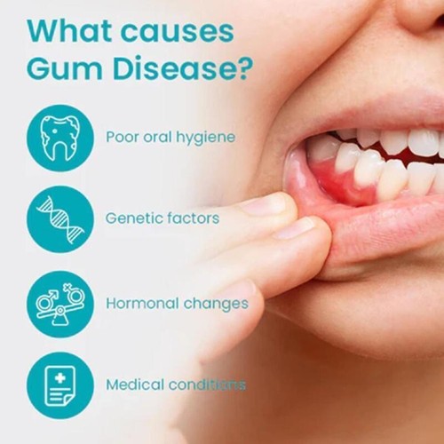 1-5x~NESLEMY Gum Shield Therapy Gel, NESLEMY Gum Shield Dentizen Gum Therapy Gel - Picture 8 of 15