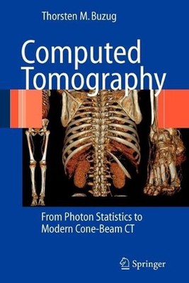 Computed Tomography: From Photon Statistics to Modern Cone-Beam CT by Thorsten M