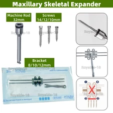 MSE Dental Palatal Expander Screw Rod Orthopaedic Mid Facial Parallel Expansion