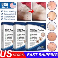 720PCS Skin Tag Remover Patches Quick Effective Mole Wart Removal Pad Sticker