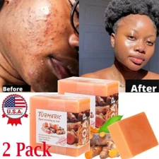 2 Pack Tumeric Soap Acne Dark Spots Removal Skin Whitening Body Bleaching Soap