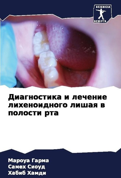 Diagnostika I Lechenie Lihenoidnogo Lishaq W Polosti Rta Sameh Sioud-image