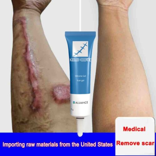 Scar Removal Cream Face Cream For Face Acne Scars Stretch Marks Remover Cream | eBay